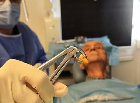 20’lik Dişin Şaşırtıcı Hikayesi: 83 Yaşında Gerçekleşen Beklenmedik Operasyon