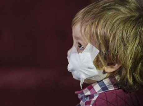 Ankara’da Pitbull Saldırısı: 1,5 Yaşındaki Efe’nin Korkunç Hikayesi