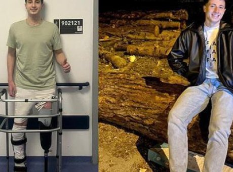 Bacağı Amputasyon Geçiren Genç Sporcu, Hayallerine Tekrar Adım Attı