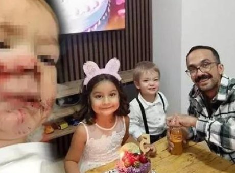 Pitbull Faciası: İki Çocuğa Saldıran Köpeğin Sahibi Ne Dedi?